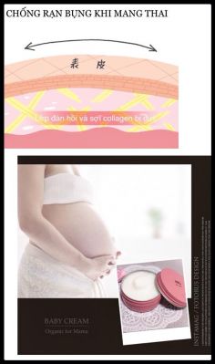 rạn bụng khi mang thai rạn bụng khi mang thai